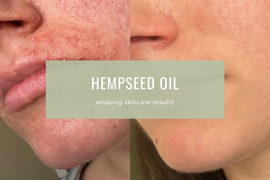 Hempseed Oil Is Good For Your Skin - Cosy Cottage Soap